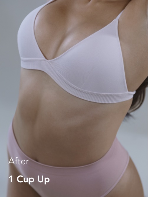 Brustvergrößerung Mia mit einer Körbchengröße größer