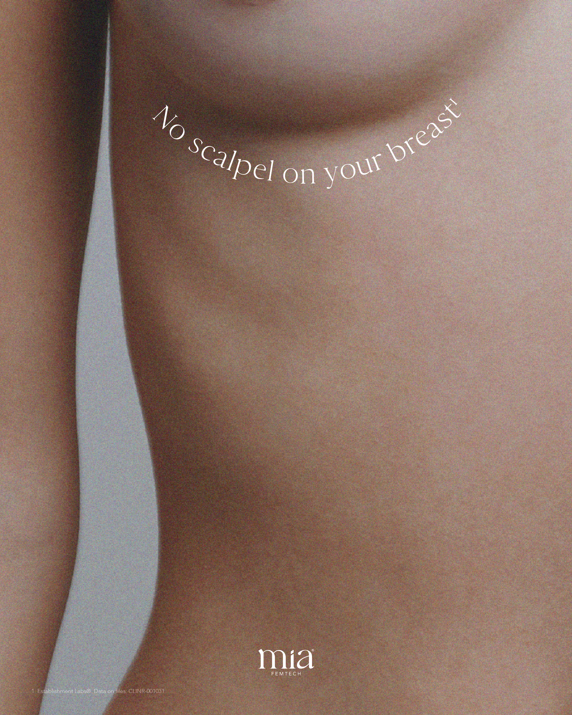 Frau nach Ihrer Brustvergr&ouml;&szlig;erung Mia ohne Narbe an der Brust